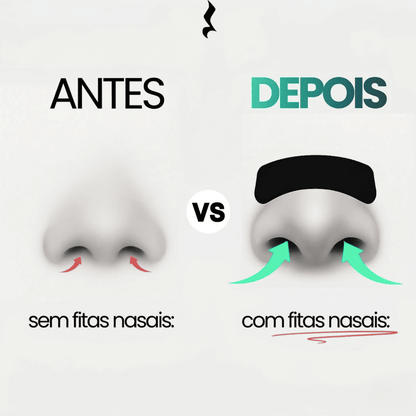 Pack Fitas Nasais